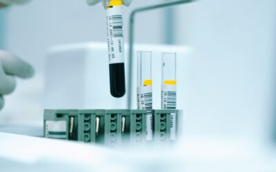 Thymosin Alpha 1: Revolutionary Immune Enhancement Research and Clinical Applications 2025
